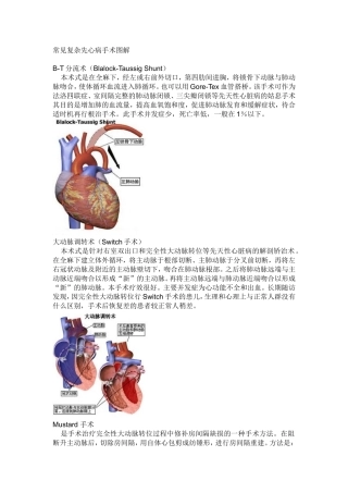 常见复杂先心病手术图解