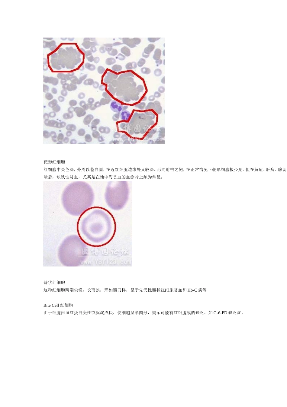 各种血细胞模式图_第2页