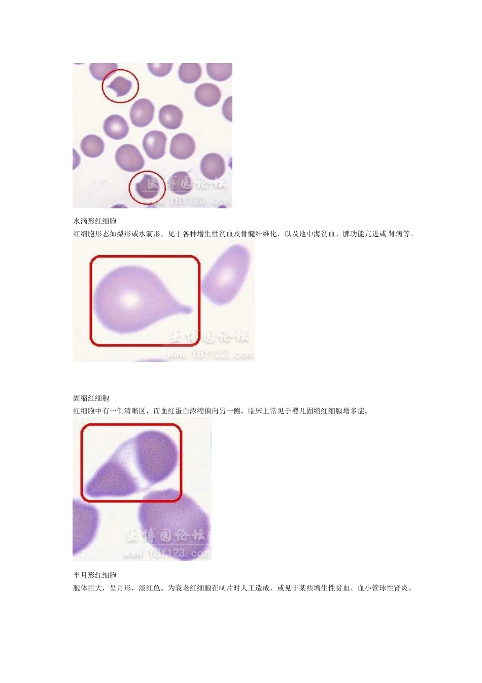 各种血细胞模式图_第3页