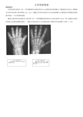 正常骨龄图谱