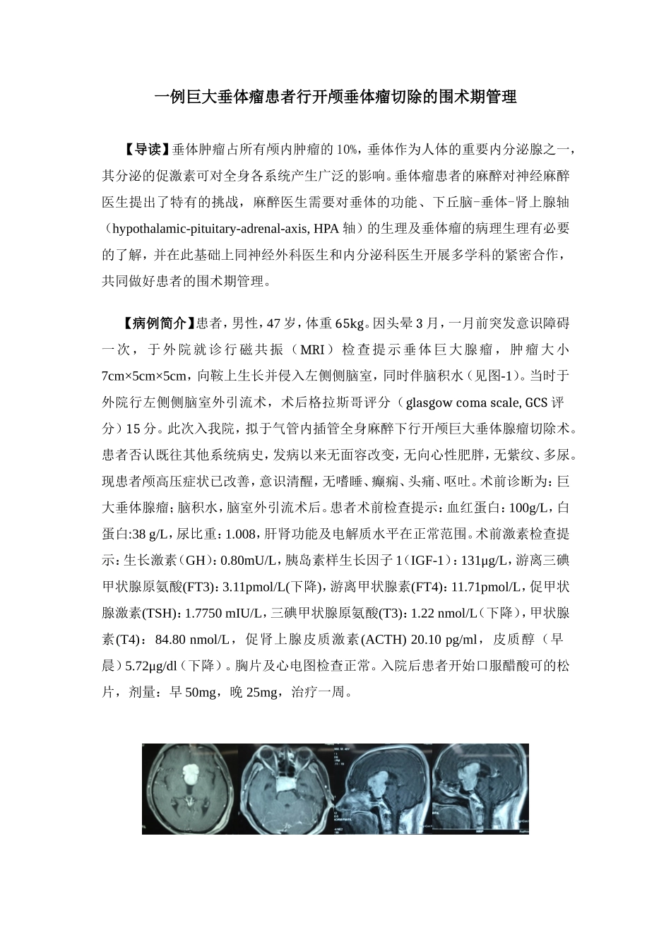 一例巨大垂体瘤患者行开颅垂体瘤切除的围术期管理_第1页