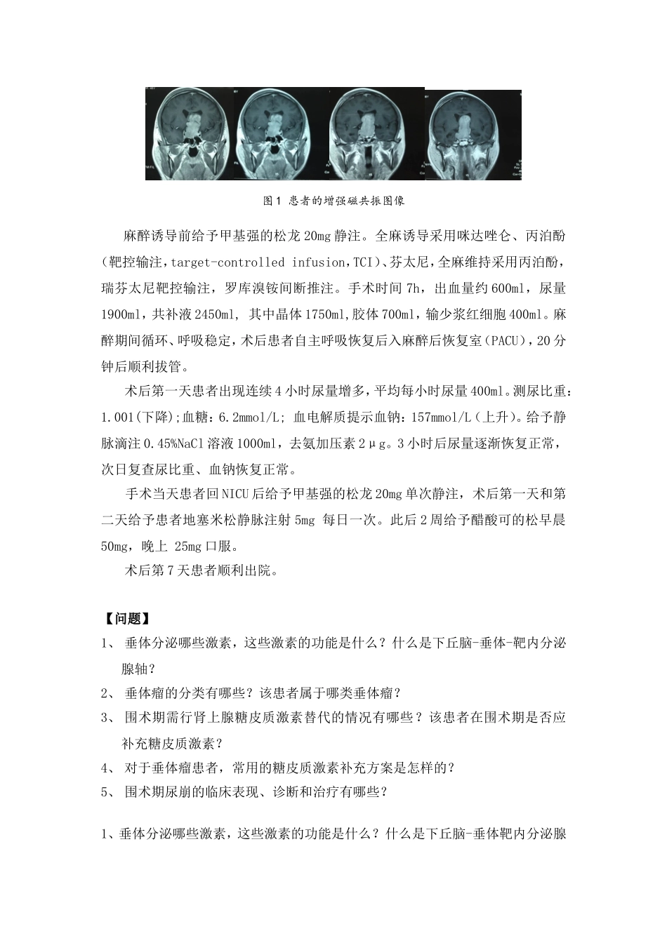 一例巨大垂体瘤患者行开颅垂体瘤切除的围术期管理_第2页