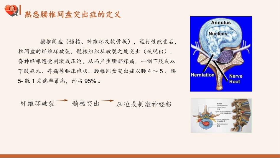 腰椎骨科护理查房_第3页