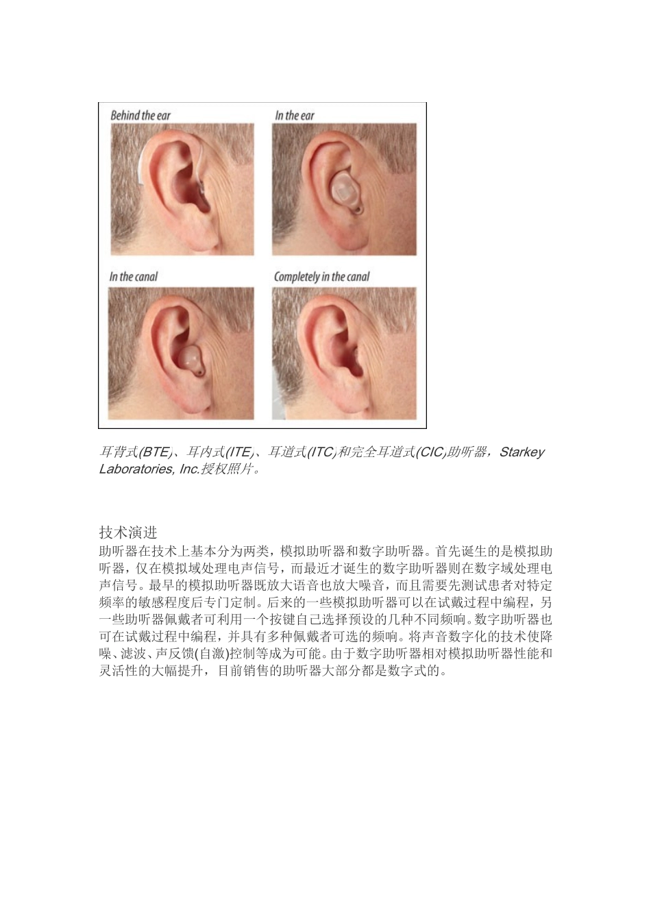 助听器介绍及其设计要点_第2页