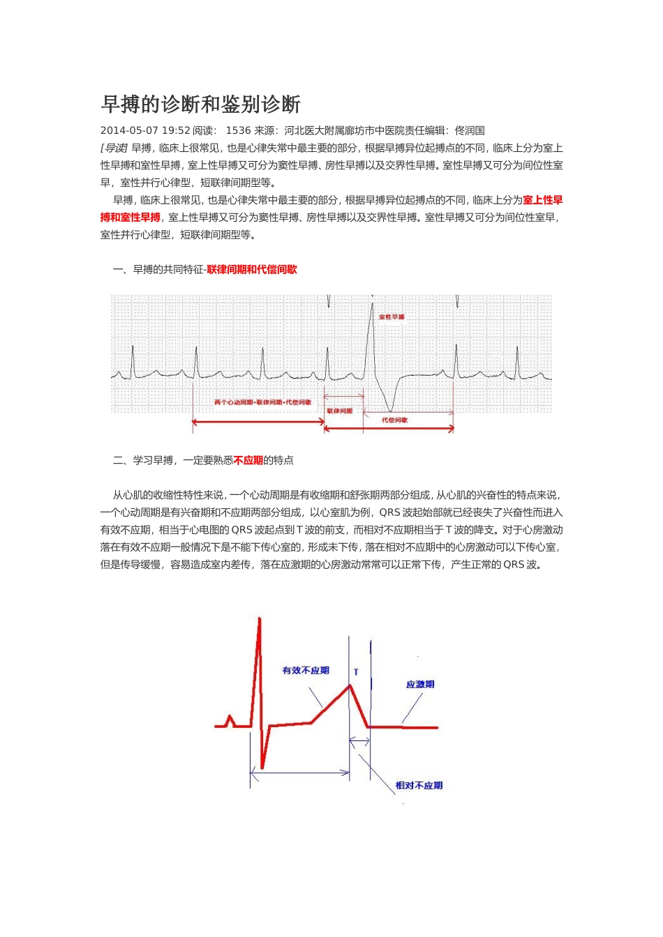早搏的诊断和鉴别诊断_第1页