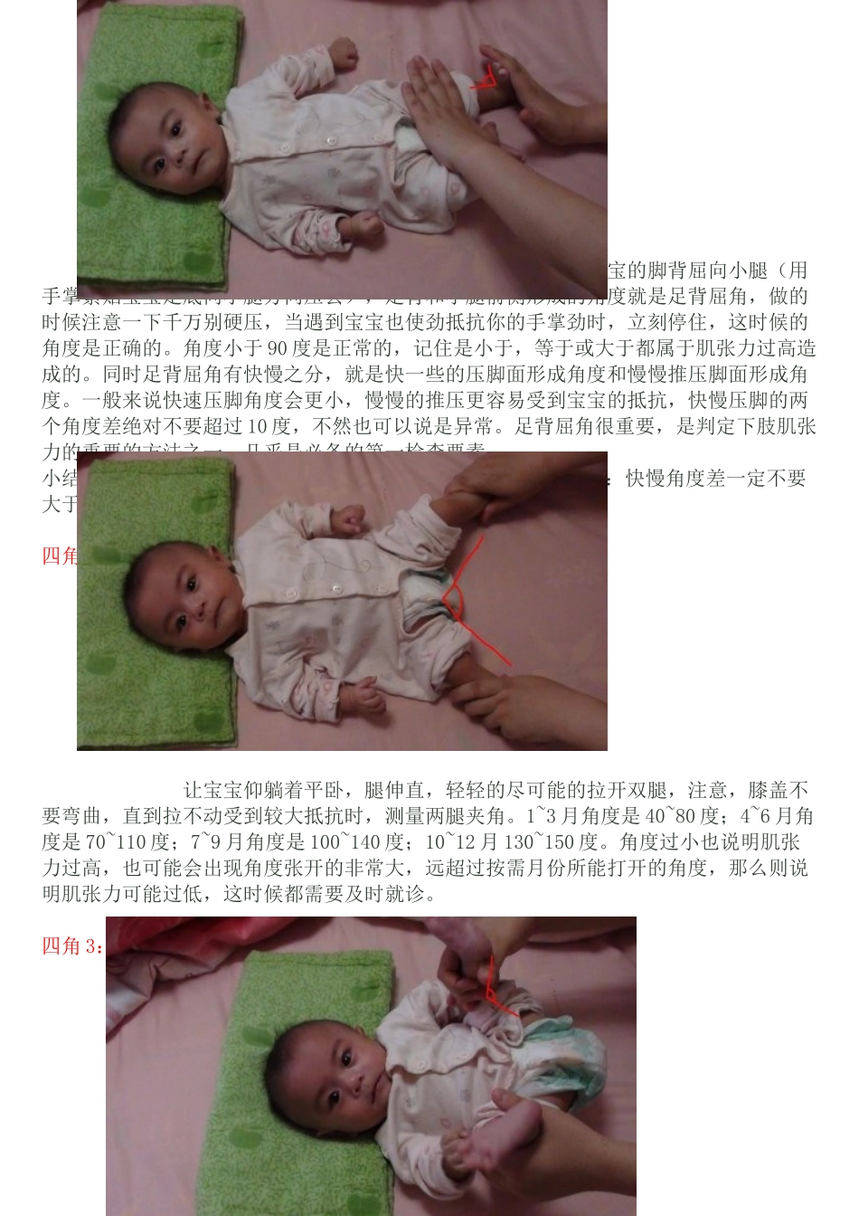 家长如何发现早产宝宝姿势异常_第2页