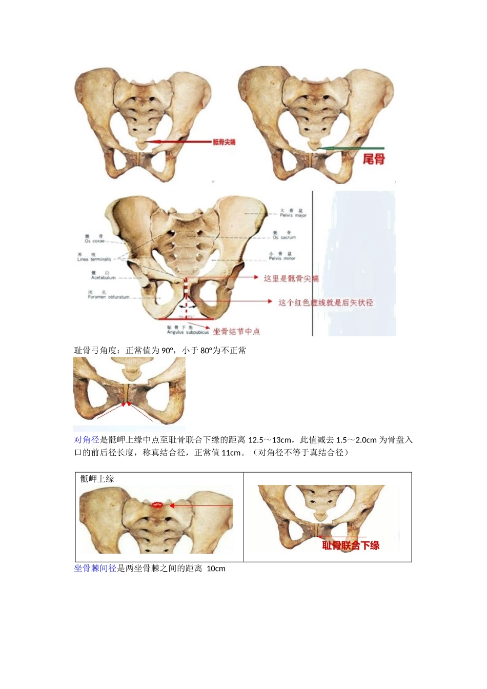 骨盆知识梳理汇总_第3页