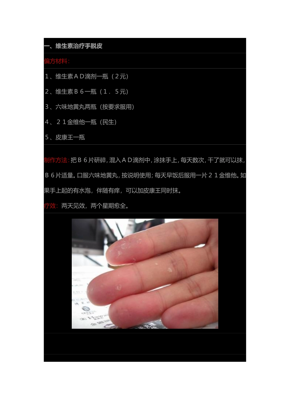 维生素治疗手脱皮测试题_第1页