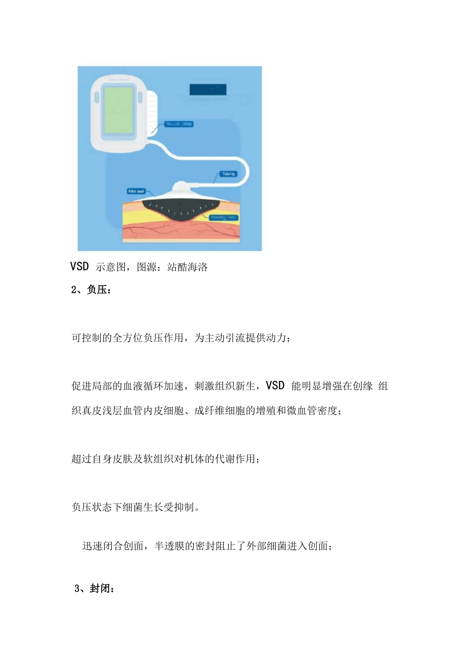2022年VSD 操作流程、并发症处理及注意事项(全文)_第2页