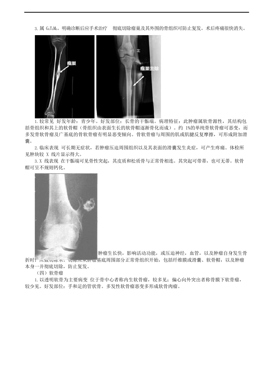 骨肿瘤考点总结_第2页