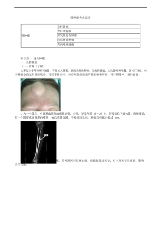 骨肿瘤考点总结