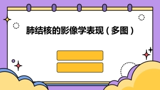 肺结核的影像学表现(多图)