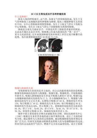 DC-CIK生物免疫治疗各种肿瘤疾病