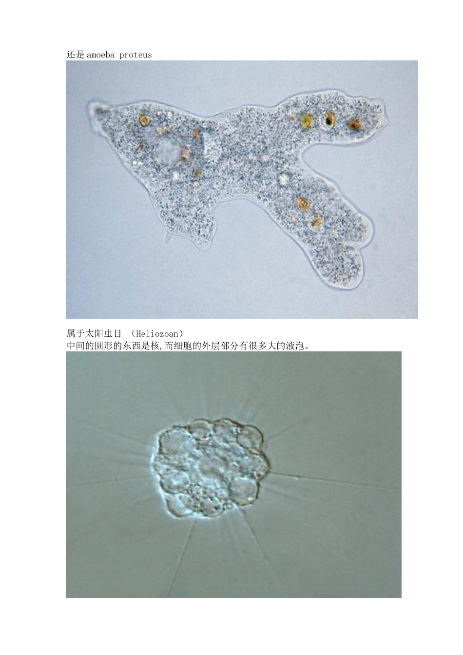 污水处理常见微生物照片_第3页