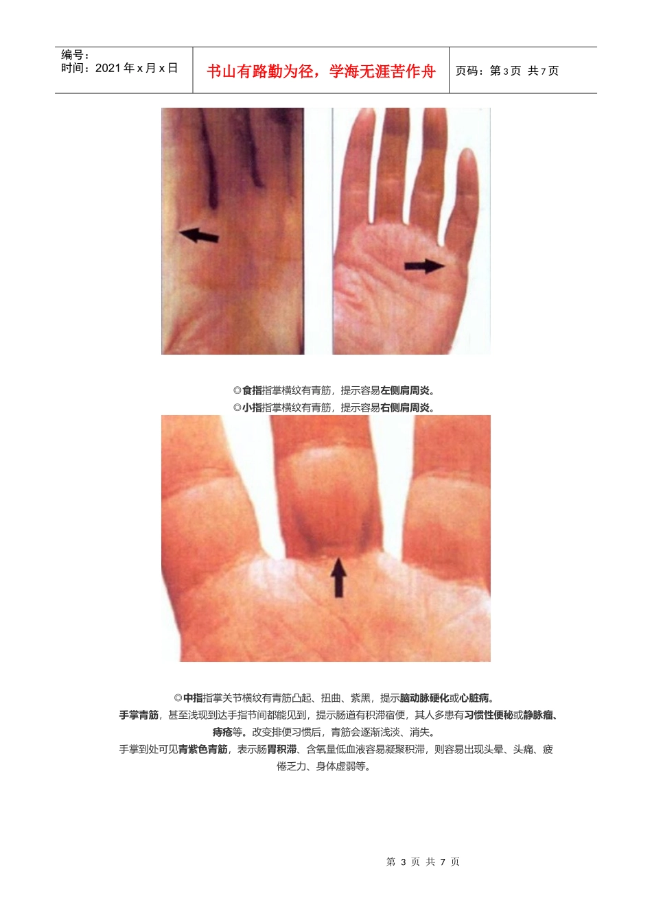 从青筋异常凸起及推测疾病管理知识分析_第3页