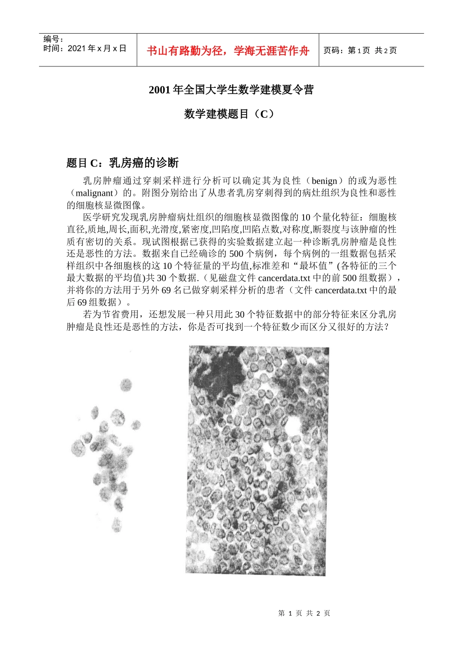 乳房癌的诊断_第1页