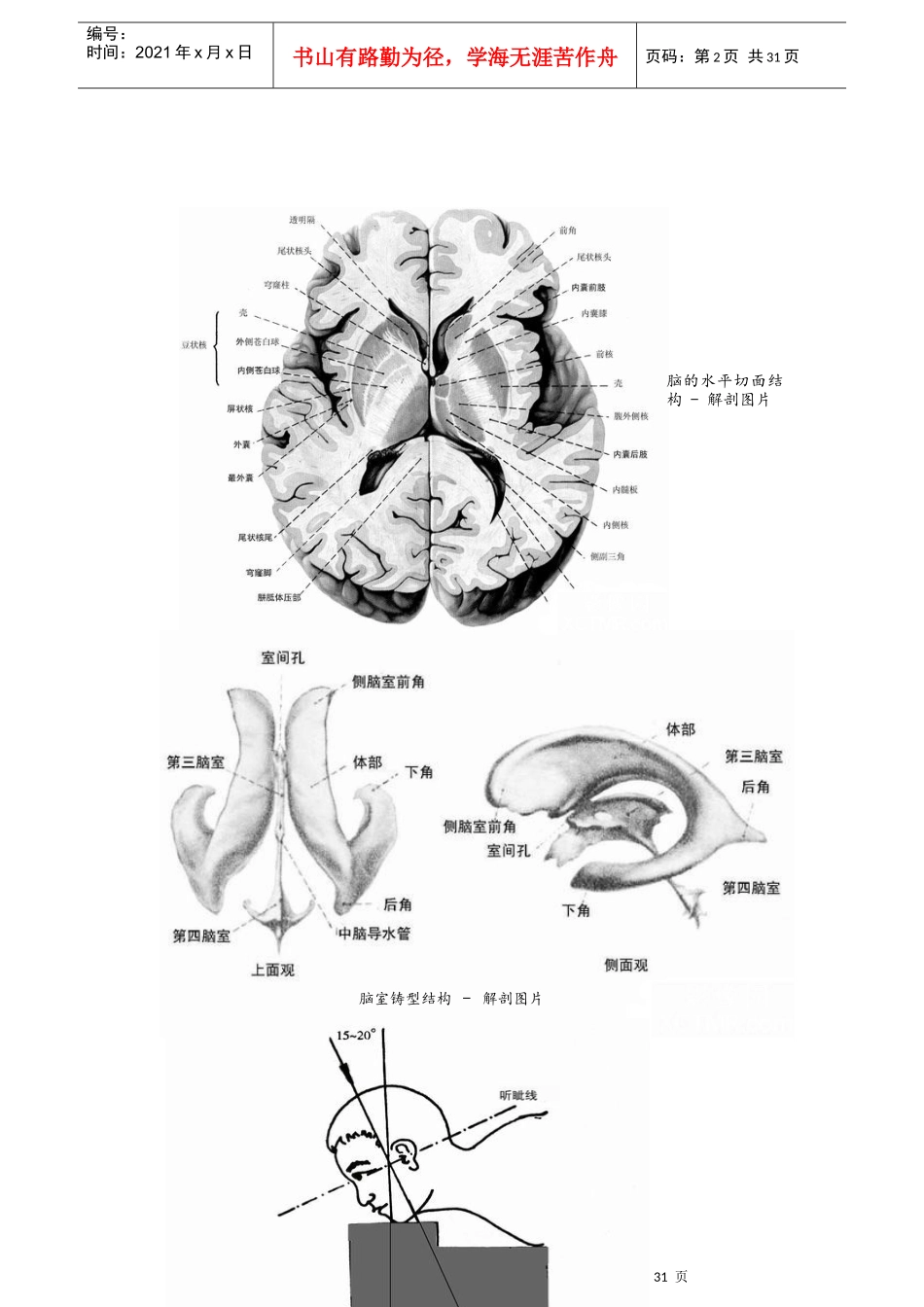 CT诊断图谱_第2页
