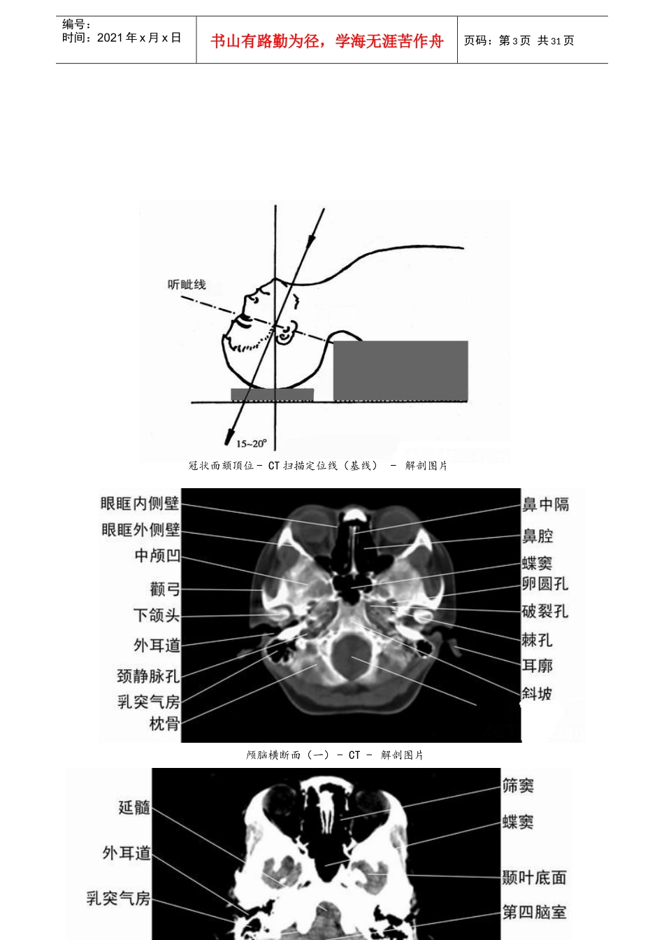 CT诊断图谱_第3页