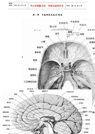 CT诊断图谱
