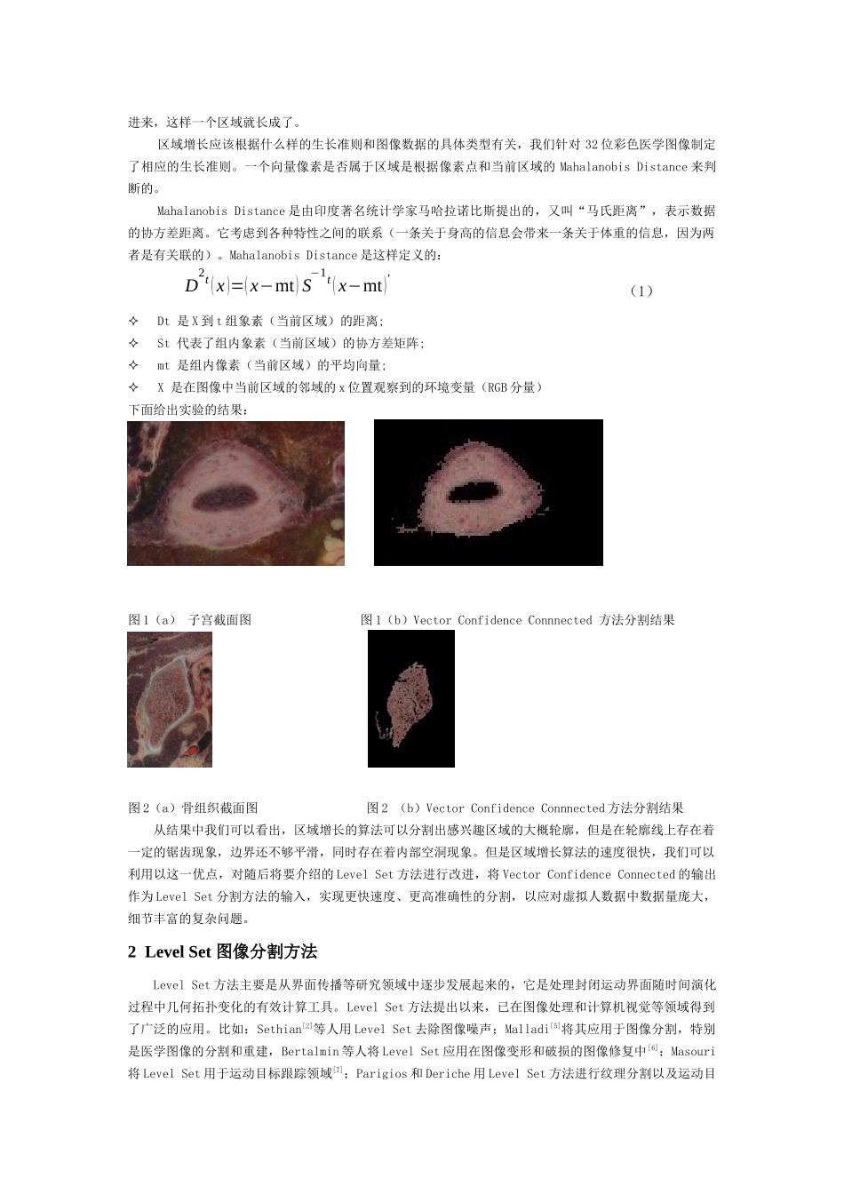 基于levelset方法的虚拟人图像处理_第2页