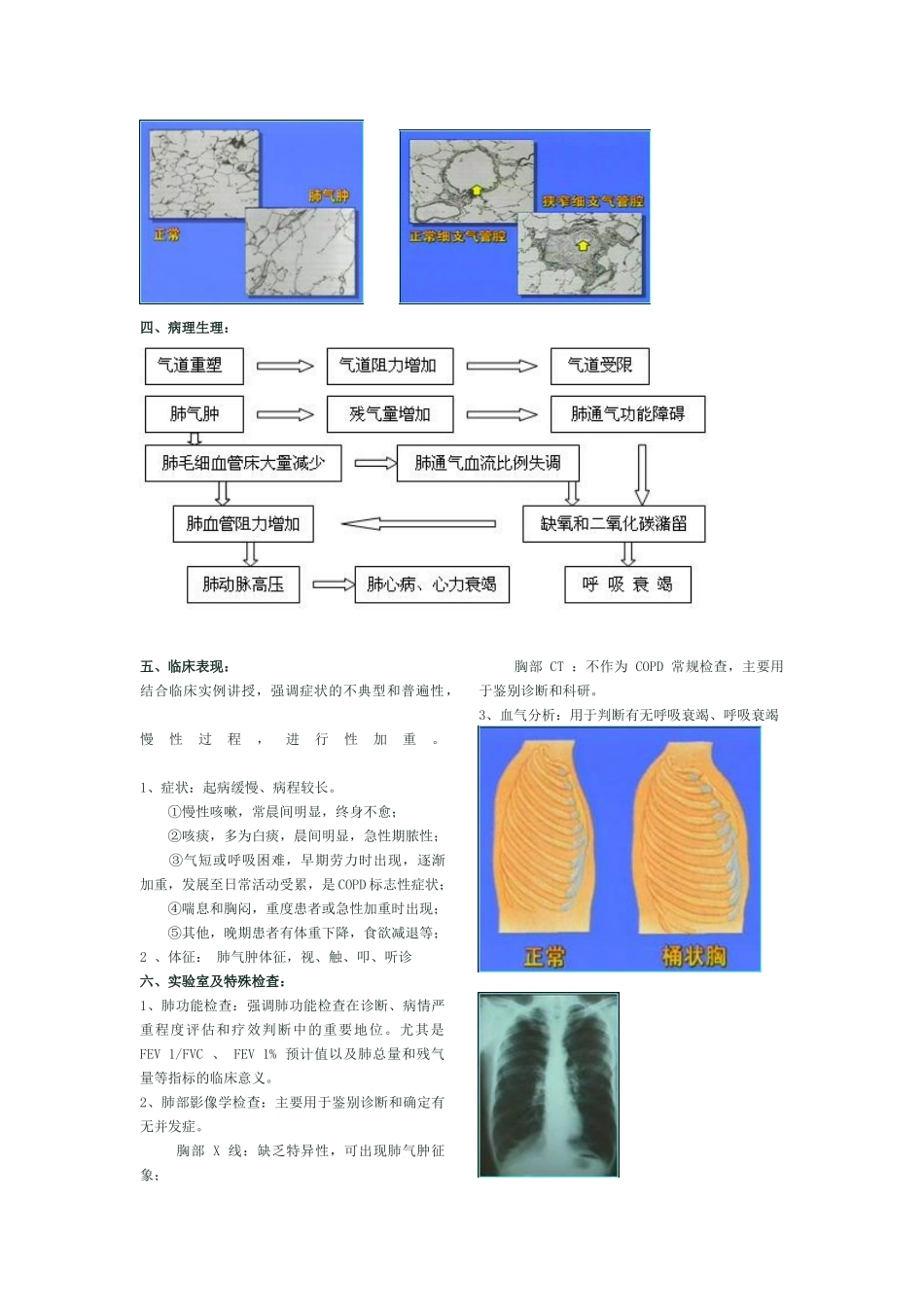 慢性阻塞性肺疾病讲稿-慢性阻塞性肺疾病_第3页