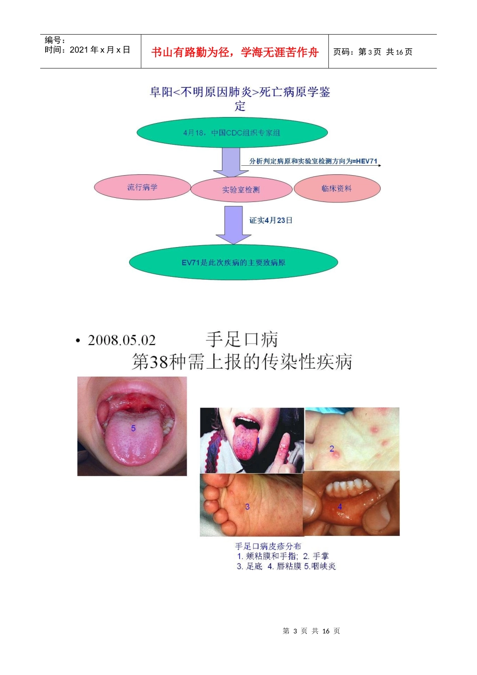 手足口病理学及其诊断课件_第3页
