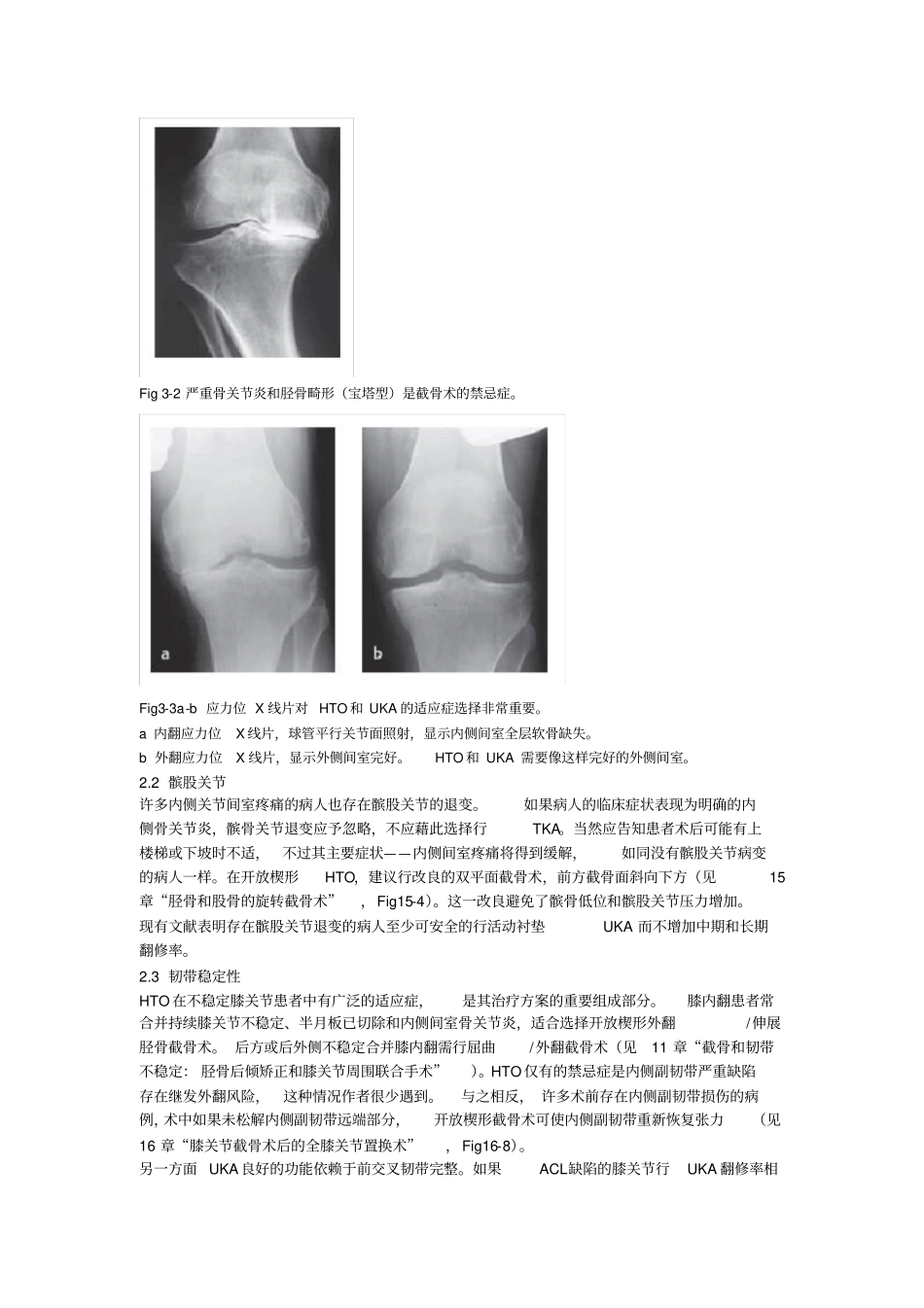 (完整)第3章胫骨高位截骨、膝关节单髁置换和全膝关节置换的适应症_第2页