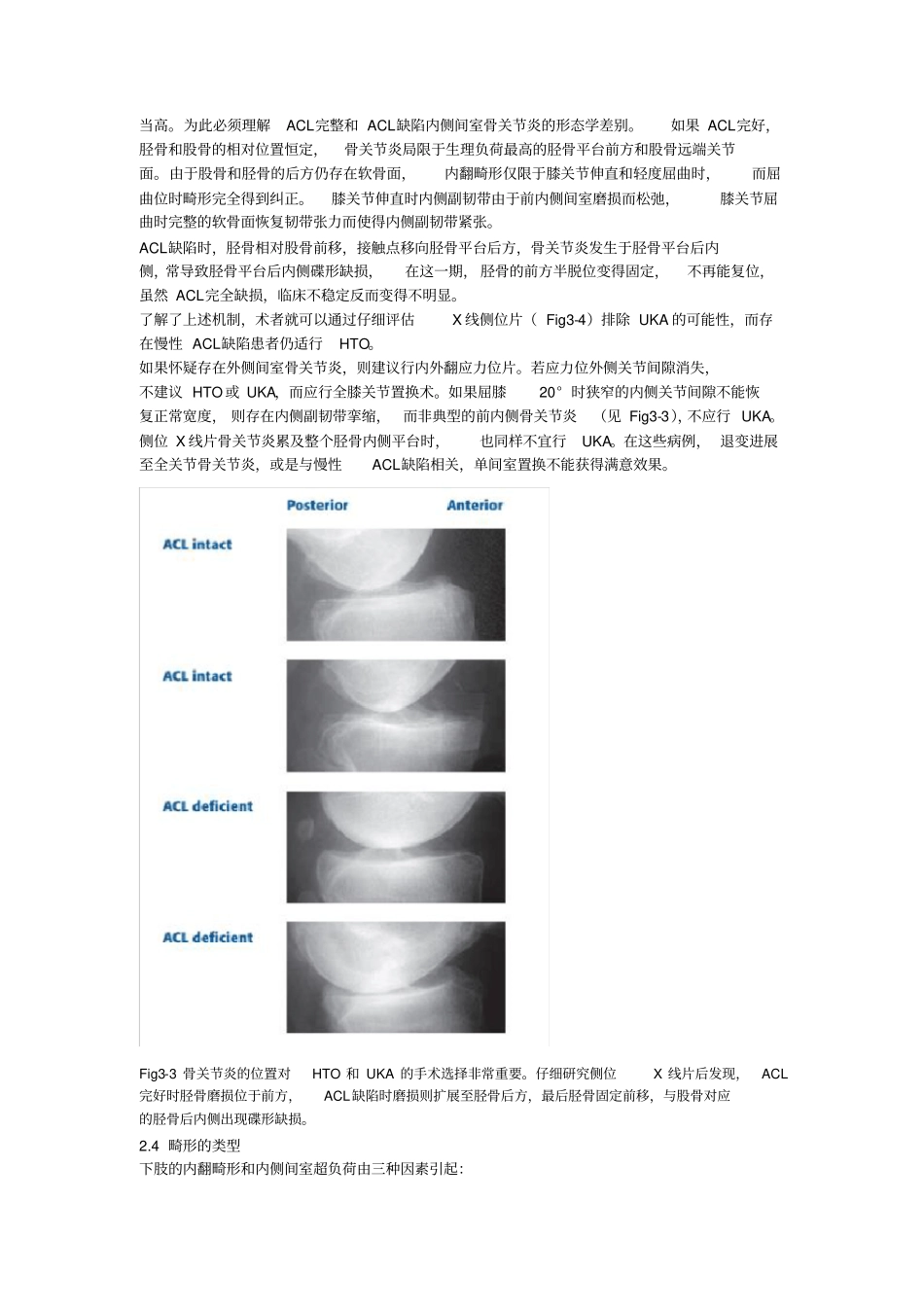 (完整)第3章胫骨高位截骨、膝关节单髁置换和全膝关节置换的适应症_第3页