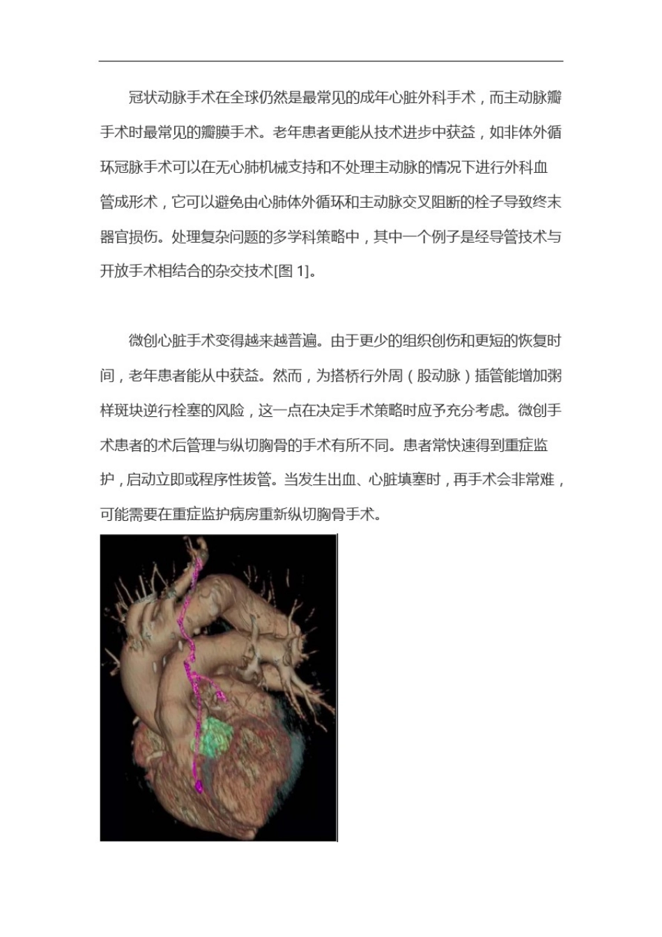 心脏术后患者的重症管理进展(完整版)_第2页