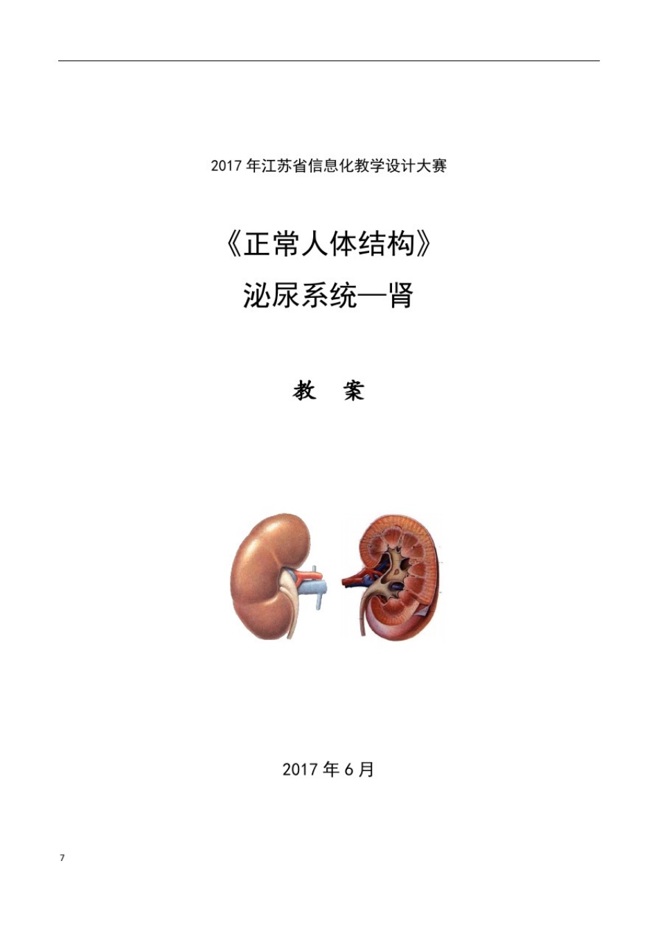 信息化教学设计教案-人体解剖学泌尿系统_第1页