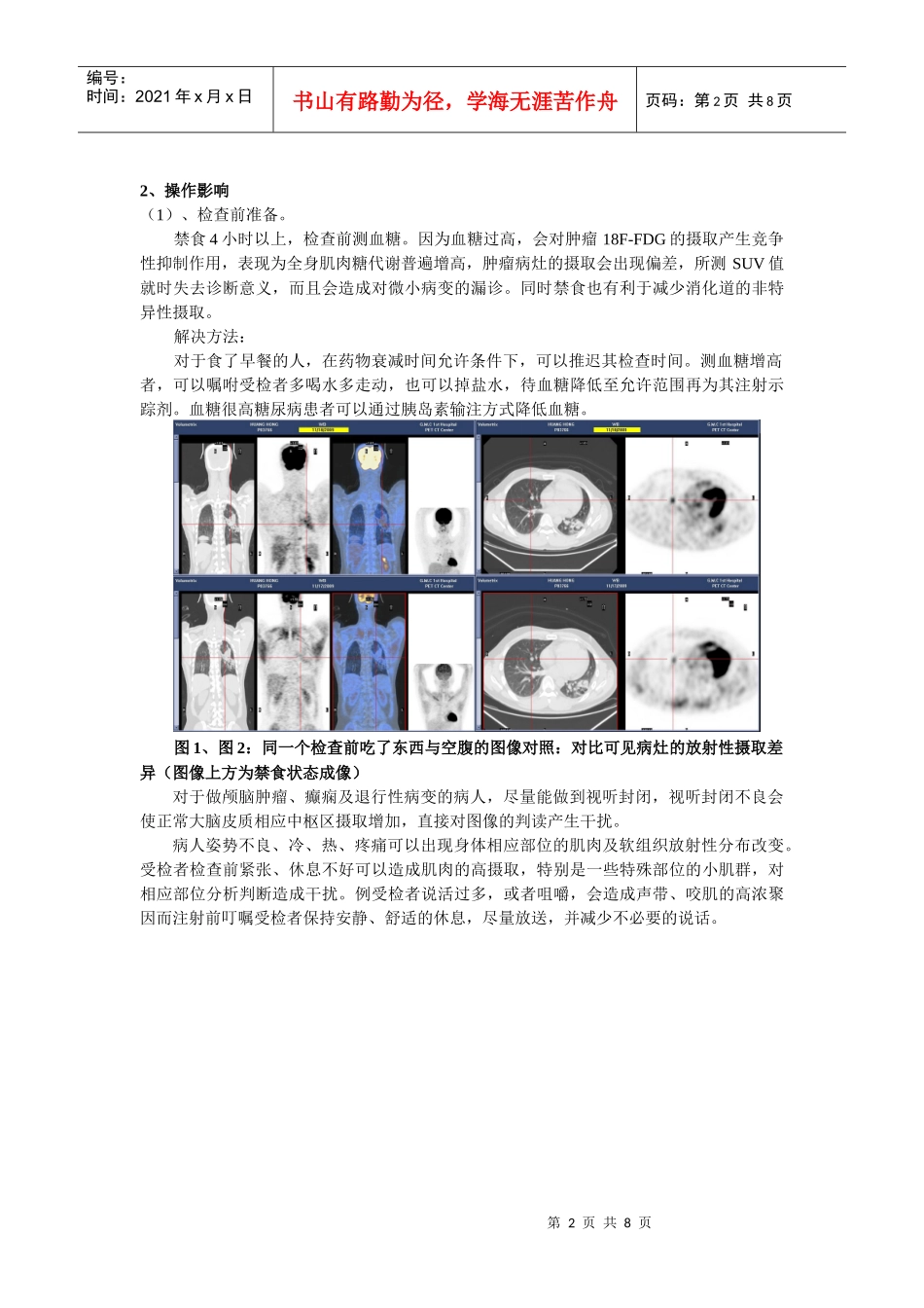 示踪剂注射时间及扫描采集时间的影响_第2页