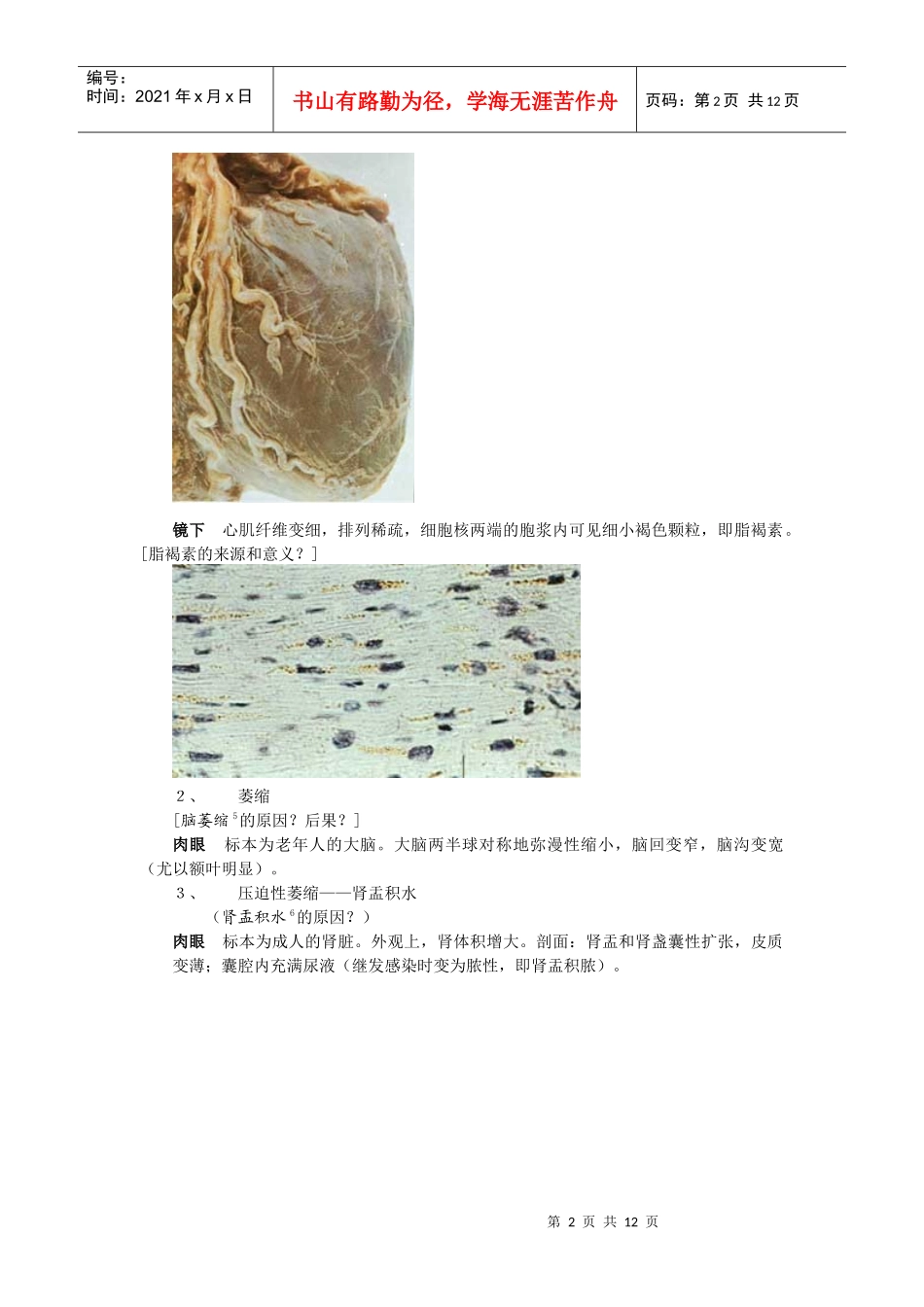 细胞、组织的适应和损伤讲义_第2页