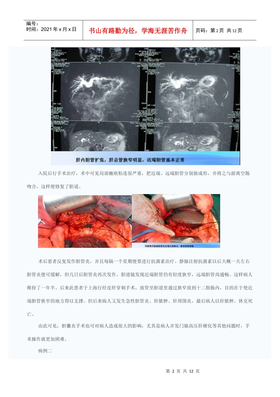 胆囊炎的诊断与外科治疗_第2页