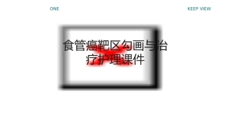 食管癌靶区勾画与治疗护理课件