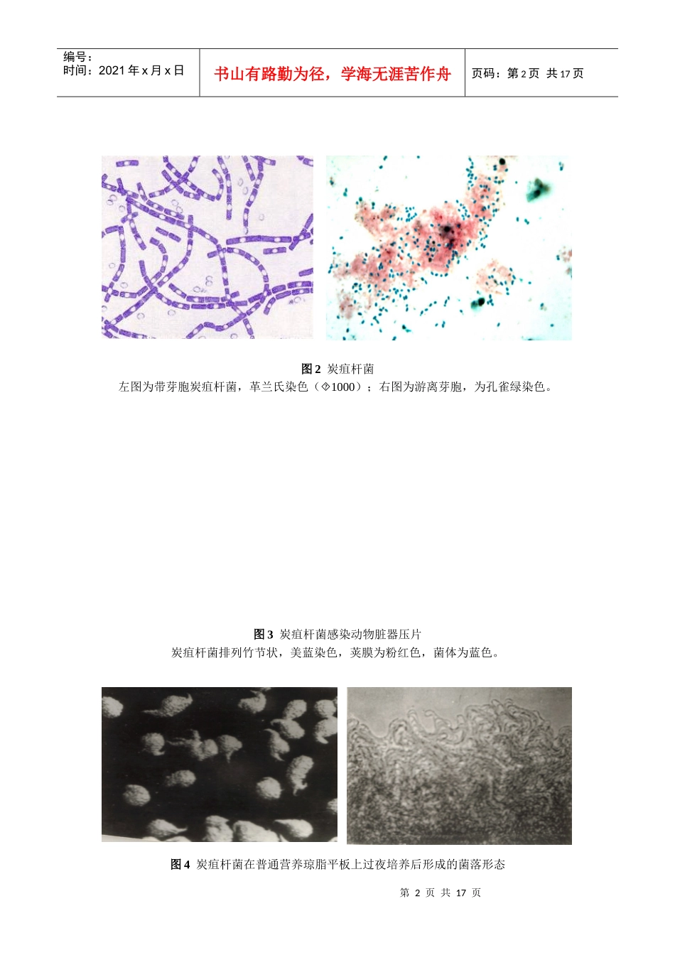 炭疽病诊断治疗与处置方案_第2页