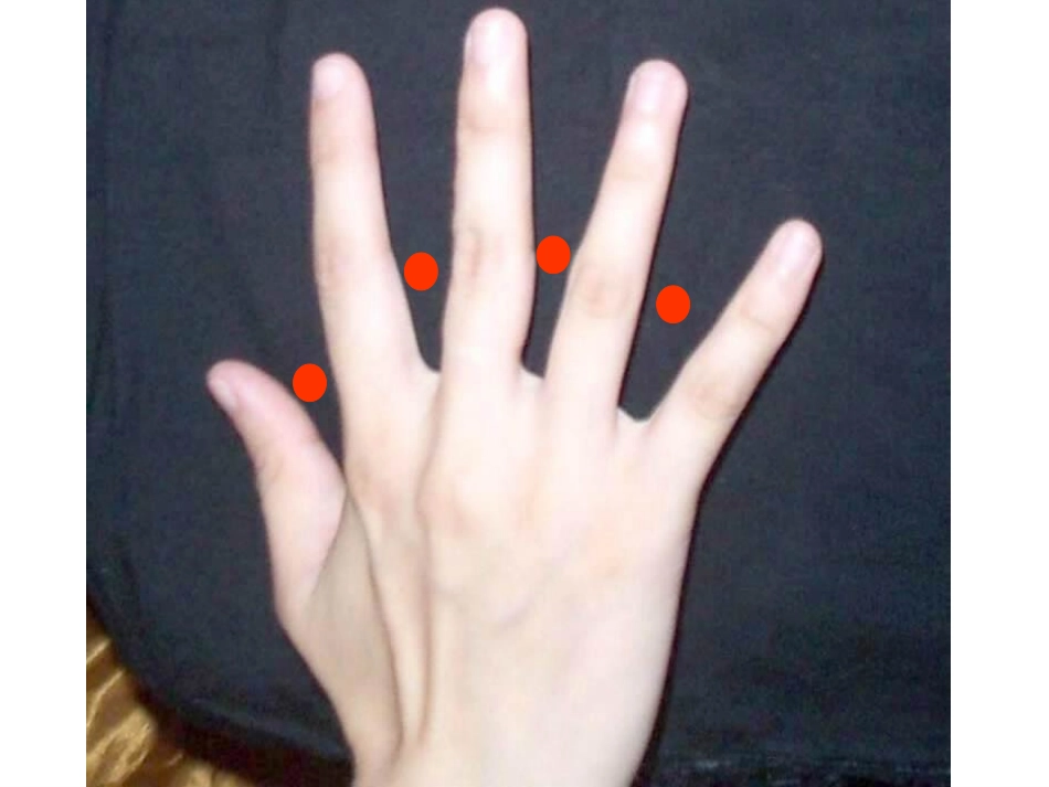 植树问题张利全_第3页