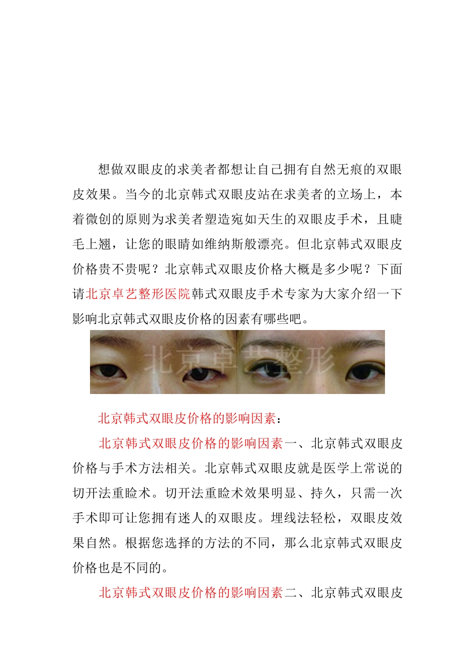 浅析北京韩式双眼皮价格_第1页