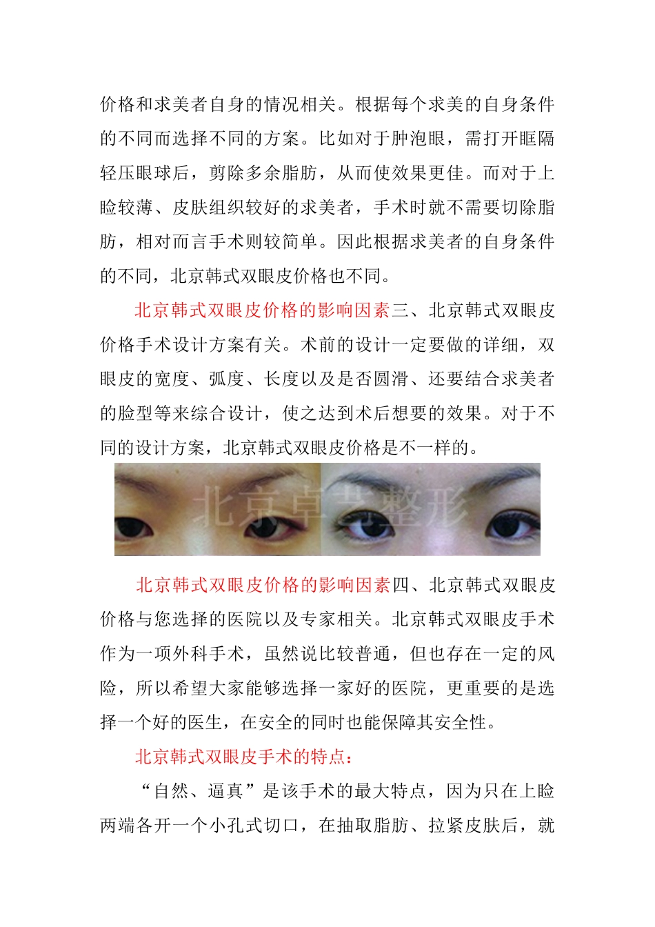 浅析北京韩式双眼皮价格_第2页