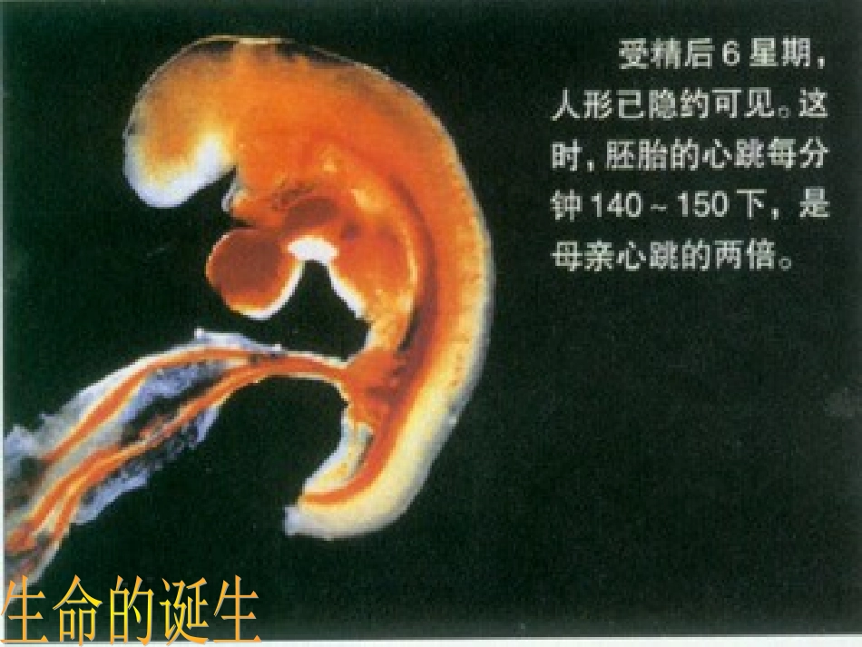 八年级政治上册 第二单元第二节 珍爱我们的生命A 课件 湘教版_第3页