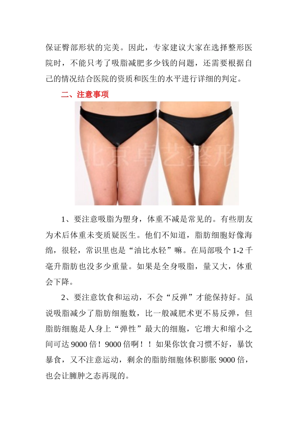 吸脂手术价格_第3页