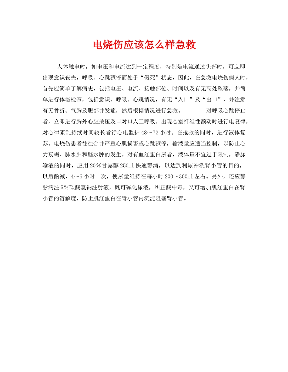 《安全常识-灾害防范》之电烧伤应该怎么样急救 _第1页