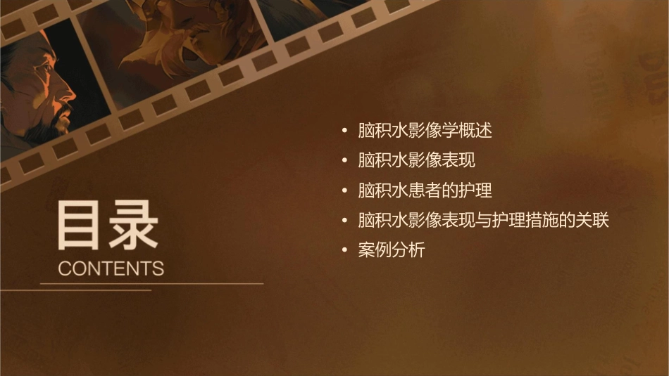 脑积水影像表现护理课件_第2页