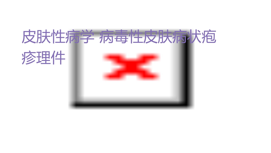 皮肤性病学 病毒性皮肤病带状疱疹诊疗护理课件_第1页