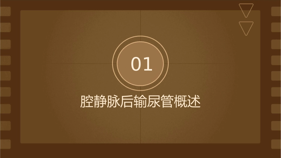 腔静脉后输尿管资料课件_第3页