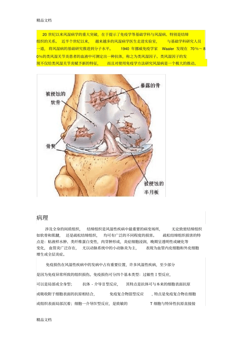 (整理)风湿性疾病_第2页