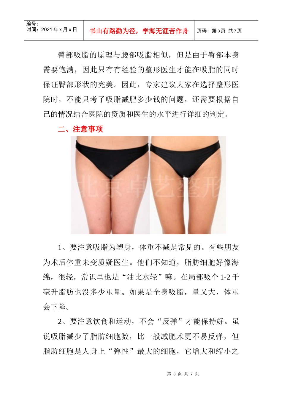 吸脂手术价格_第3页