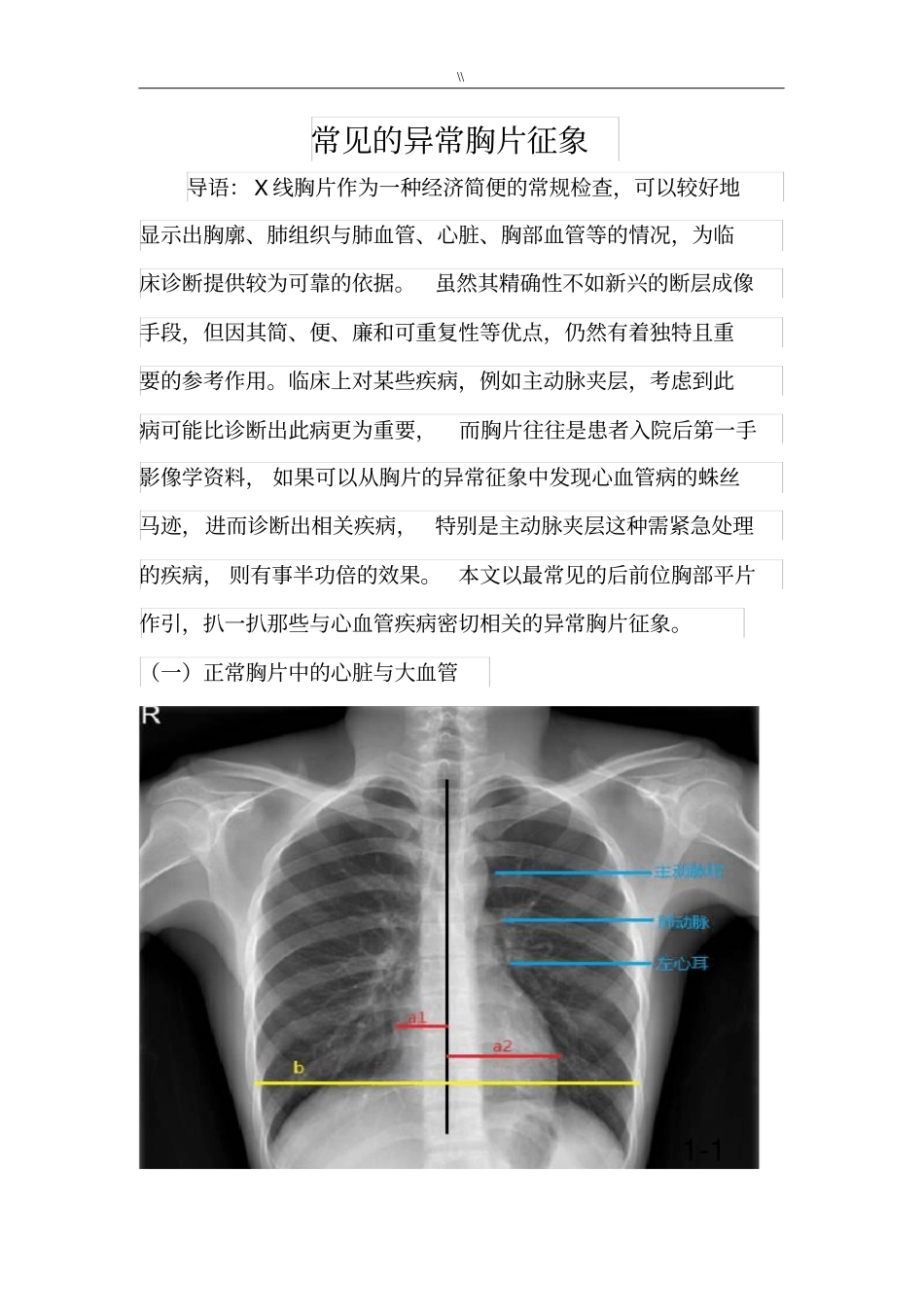 常见地X线胸片资料_第1页