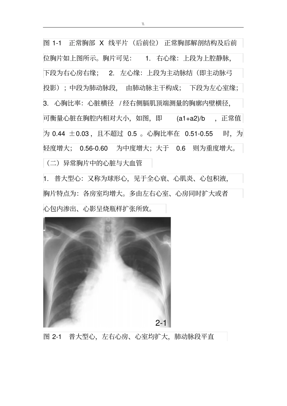 常见地X线胸片资料_第2页