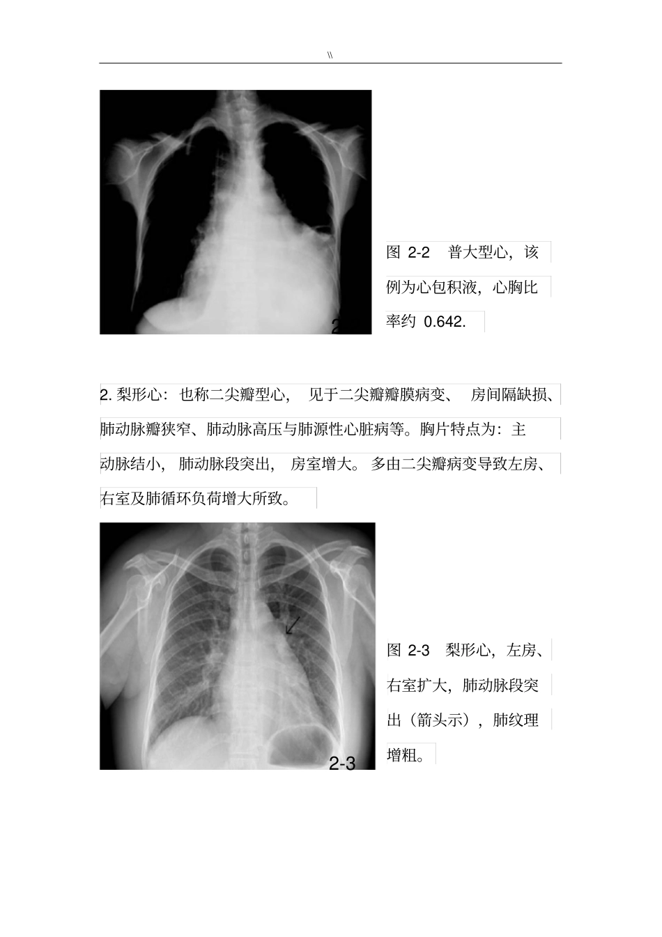 常见地X线胸片资料_第3页