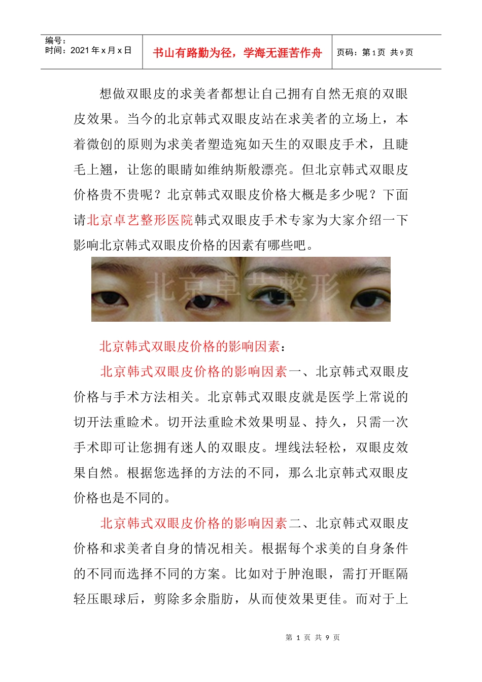 北京韩式双眼皮价格_第1页